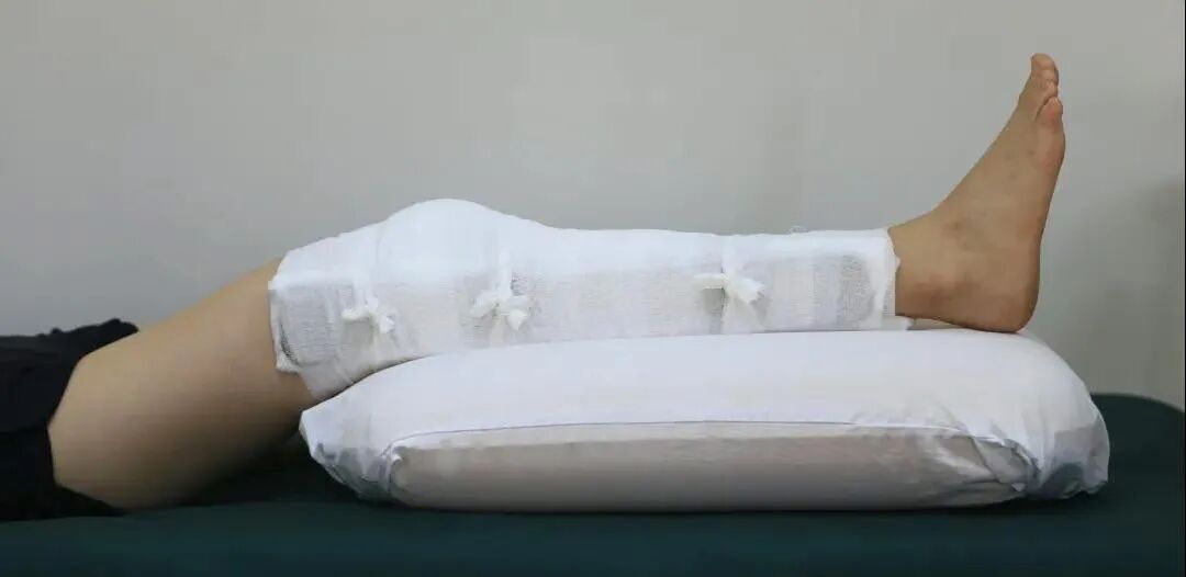 医用夹板怎么软化高分子夹板外固定后出院该注意些什么？_https://www.jmylbn.com_新闻资讯_第8张