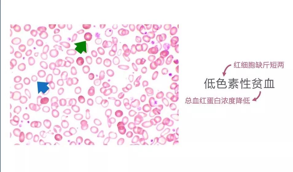 红细胞是什么颜色的