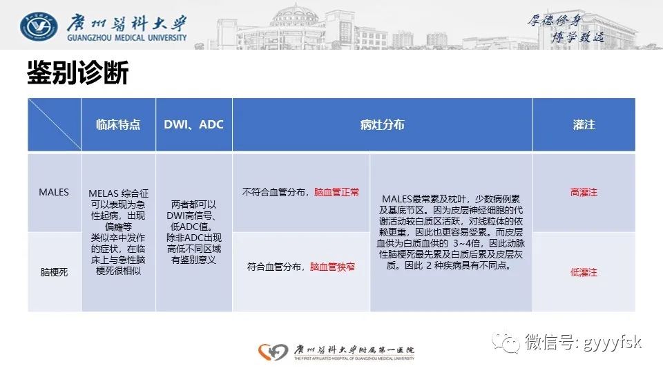 melas综合征【线粒体脑肌病伴高乳酸血症和脑卒中样发作】