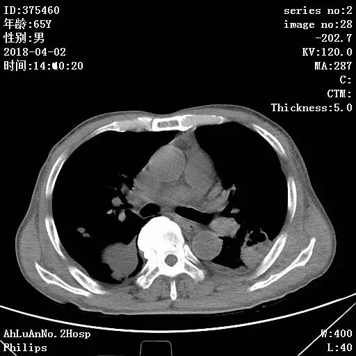 金黄葡萄球菌_葡萄蜜虫钓黄辣丁_伤口黄金色葡萄菌感染