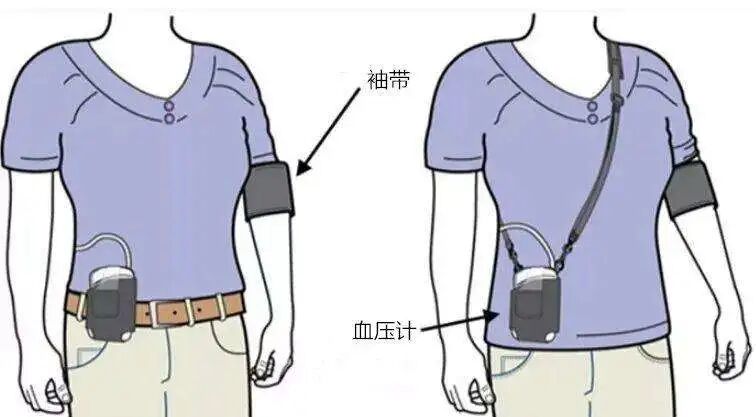 动态血压监测仪怎么用动态血压监测注意事项_https://www.jmylbn.com_新闻资讯_第4张