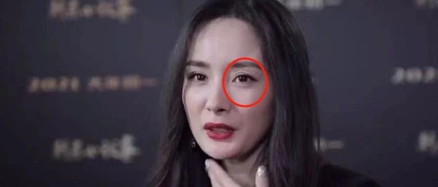 杨幂的眼睛怎么了？出现怪异褶皱双眼不对称，再一次引网友质疑整容？