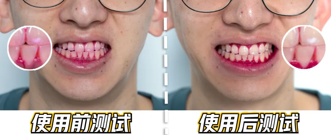 500+机构推荐!好易康8号降火牙膏,复旦大学生命科学院研发、独有生物溶菌酶,杀灭顽固细菌、实力降火,长期使用也不会产生抗药性! 500+机构推荐!好易康8号降火牙膏,复旦大学生命科学院研发、独有生物溶菌酶,杀灭顽固细菌、实力降火,长期使用也不会产生抗药性!