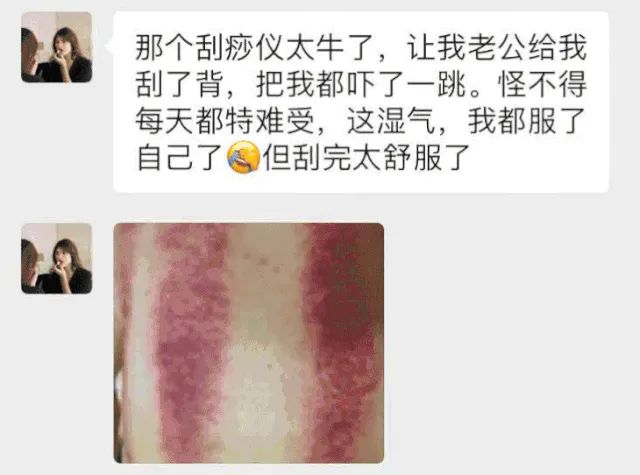黑科技智能拔罐+刮痧了解下?无线电动刮痧仪,磁吸按摩头+负压技术、吸痧+走罐+热敷,祛湿降火效果翻倍。科技养生,方便、舒服更有效 黑科技智能拔罐+刮痧了解下?无线电动刮痧仪,磁吸按摩头+负压技术、吸痧+走罐+热敷,祛湿降火效果翻倍。科技养生,方便、舒服更有效