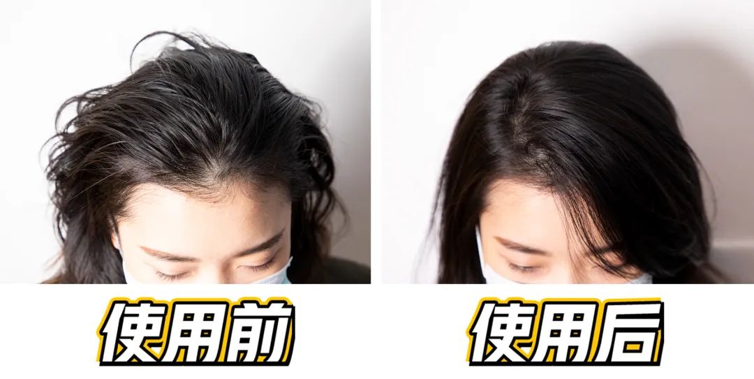 韩国之光、全球专业头皮护理专家Dr.FORHAIR发笙泡泡慕斯洗发水,进口精纯氨基酸+4种黑科技专利成分,强悍控油、洗1次管3天 韩国之光、全球专业头皮护理专家Dr.FORHAIR发笙泡泡慕斯洗发水,进口精纯氨基酸+4种黑科技专利成分,强悍控油、洗1次管3天