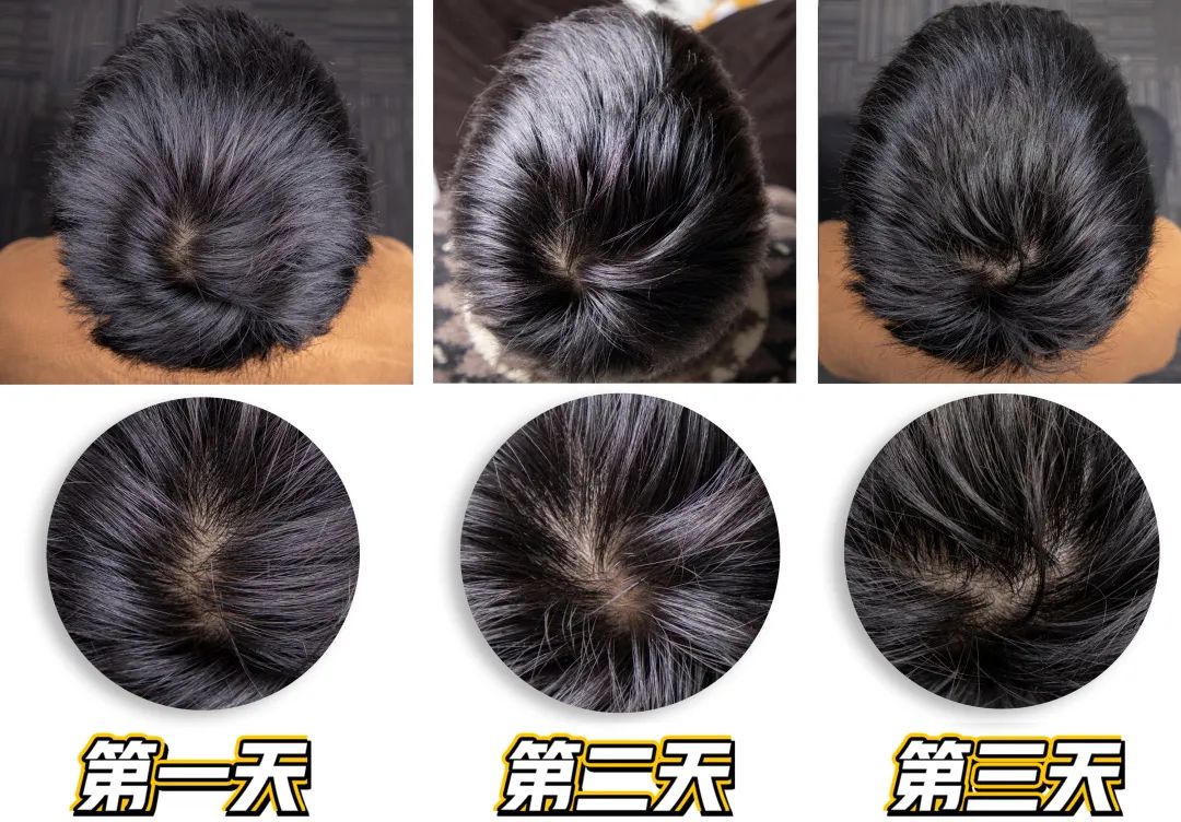 韩国之光、全球专业头皮护理专家Dr.FORHAIR发笙泡泡慕斯洗发水,进口精纯氨基酸+4种黑科技专利成分,强悍控油、洗1次管3天 韩国之光、全球专业头皮护理专家Dr.FORHAIR发笙泡泡慕斯洗发水,进口精纯氨基酸+4种黑科技专利成分,强悍控油、洗1次管3天