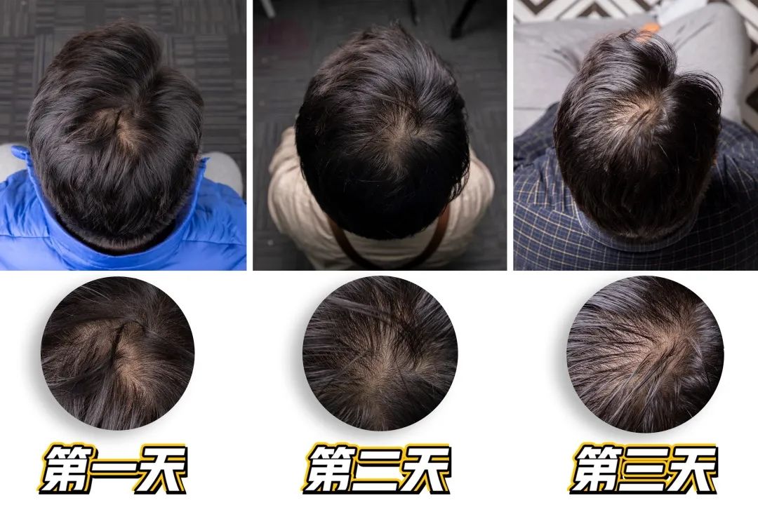 韩国之光、全球专业头皮护理专家Dr.FORHAIR发笙泡泡慕斯洗发水,进口精纯氨基酸+4种黑科技专利成分,强悍控油、洗1次管3天 韩国之光、全球专业头皮护理专家Dr.FORHAIR发笙泡泡慕斯洗发水,进口精纯氨基酸+4种黑科技专利成分,强悍控油、洗1次管3天