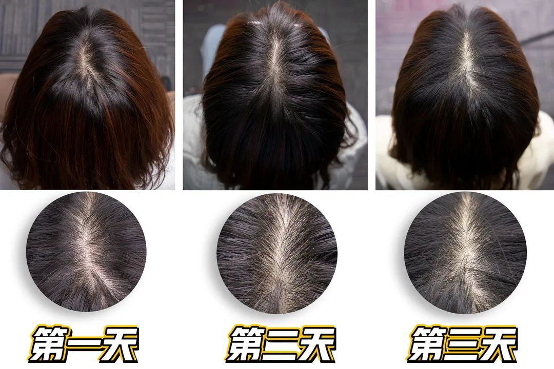 韩国之光、全球专业头皮护理专家Dr.FORHAIR发笙泡泡慕斯洗发水,进口精纯氨基酸+4种黑科技专利成分,强悍控油、洗1次管3天 韩国之光、全球专业头皮护理专家Dr.FORHAIR发笙泡泡慕斯洗发水,进口精纯氨基酸+4种黑科技专利成分,强悍控油、洗1次管3天