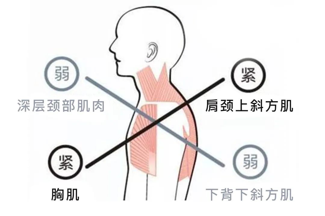 OLOEY内穿隐形矫姿带,自动矫正身姿,有效防止含胸、驼背、高低肩、脊柱侧弯等不良姿势,随时给人最佳形象、姿态优雅气质动人 OLOEY内穿隐形矫姿带,自动矫正身姿,有效防止含胸、驼背、高低肩、脊柱侧弯等不良姿势,随时给人最佳形象、姿态优雅气质动人