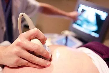 怀孕第35周，悉尼妈妈像往常一样去产检，看到B超里的图像时吓坏了... - 4