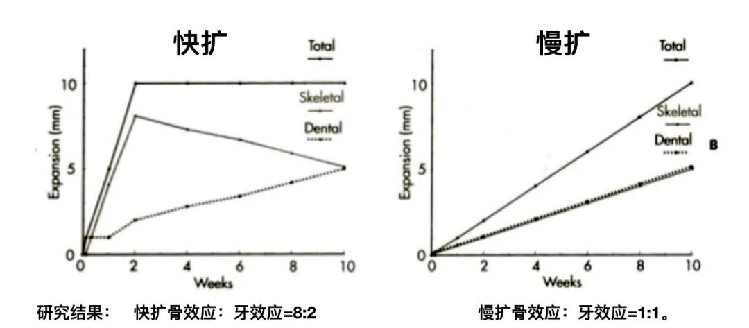 正畸临床病例——“横向先行”扩弓的方法与技巧