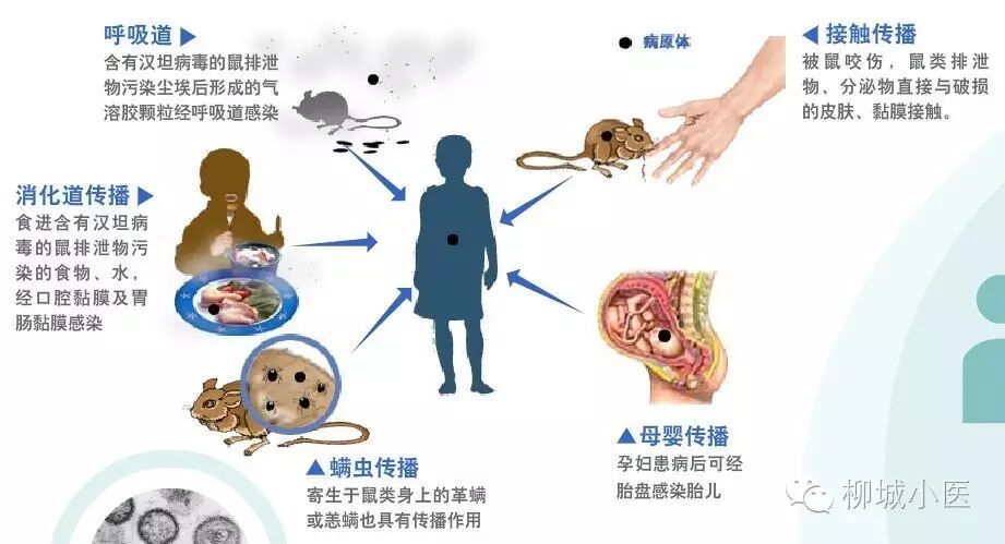 钩端螺旋体病