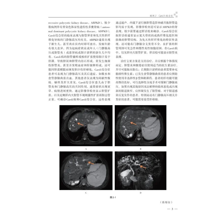 怎么买病理图文腹部疑难病例影像诊断及解析..._https://www.jmylbn.com_新闻资讯_第11张