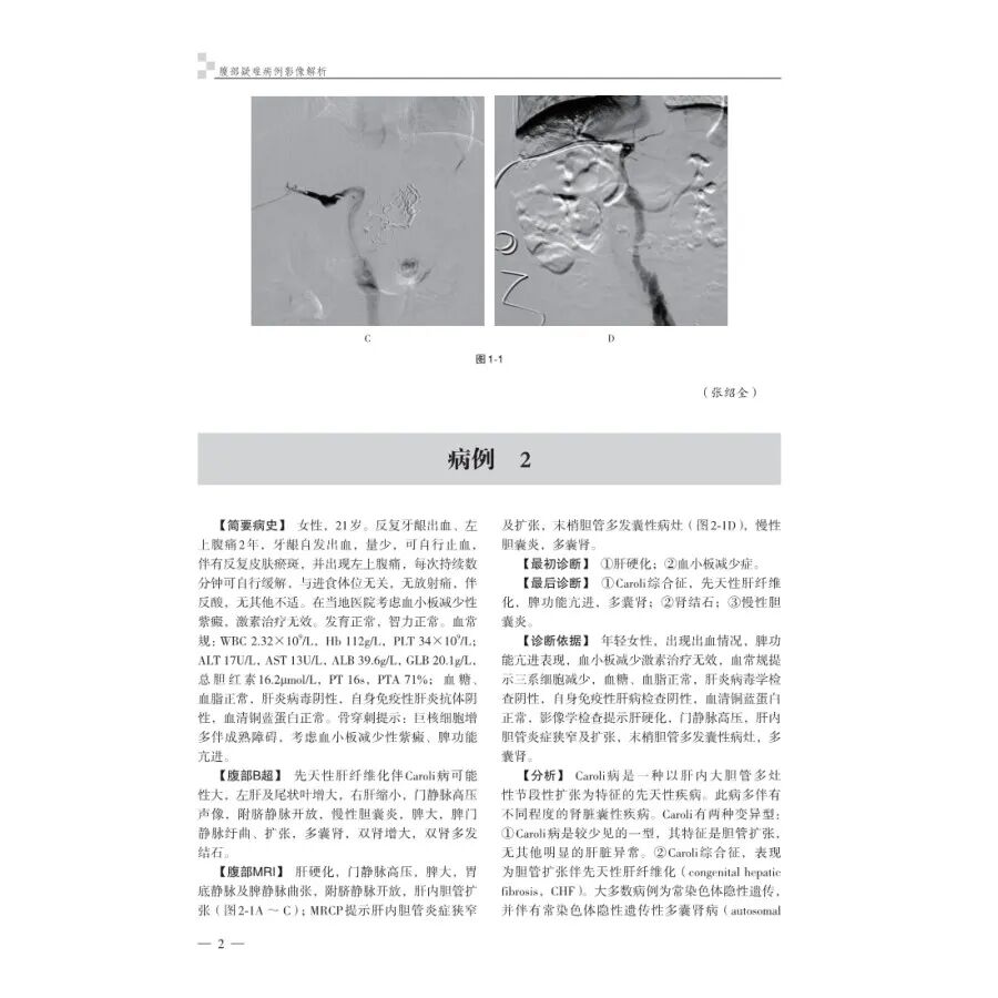 怎么买病理图文腹部疑难病例影像诊断及解析..._https://www.jmylbn.com_新闻资讯_第10张