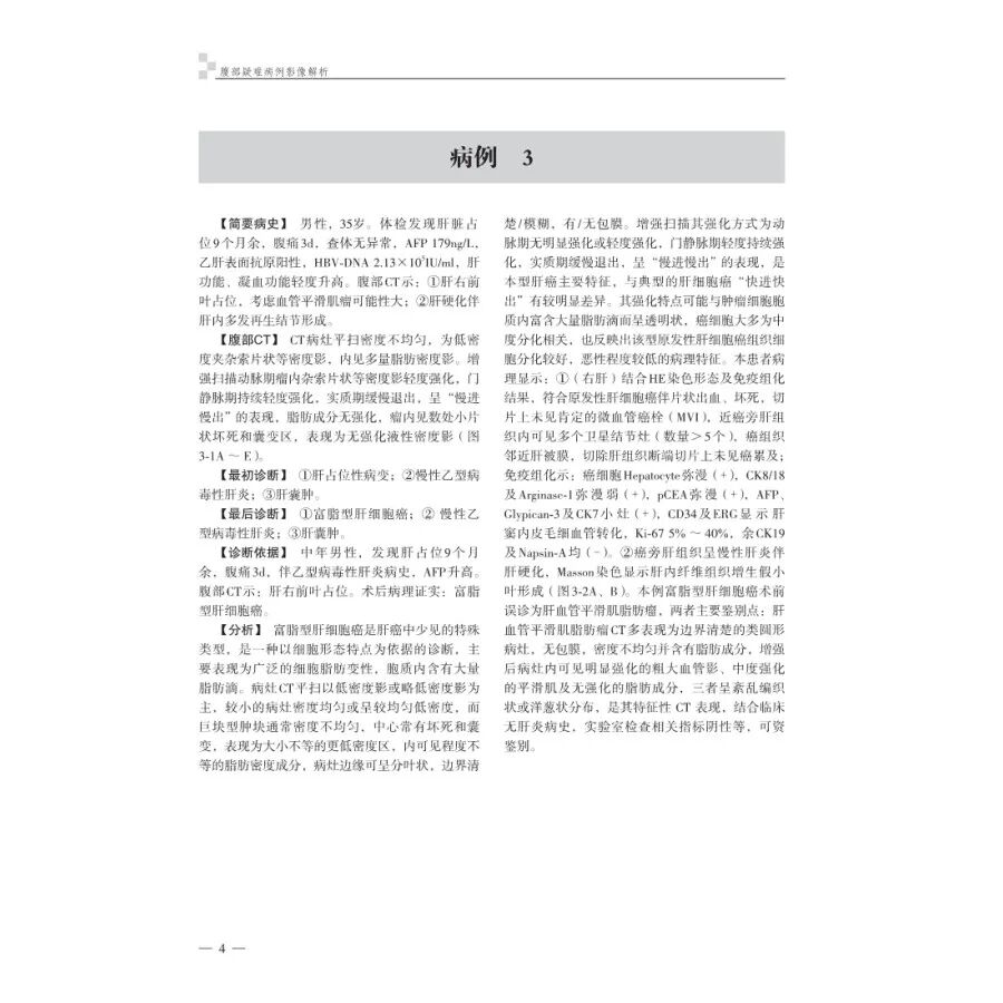 怎么买病理图文腹部疑难病例影像诊断及解析..._https://www.jmylbn.com_新闻资讯_第12张