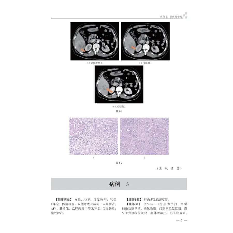 怎么买病理图文腹部疑难病例影像诊断及解析..._https://www.jmylbn.com_新闻资讯_第15张
