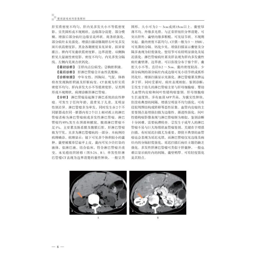 怎么买病理图文腹部疑难病例影像诊断及解析..._https://www.jmylbn.com_新闻资讯_第16张