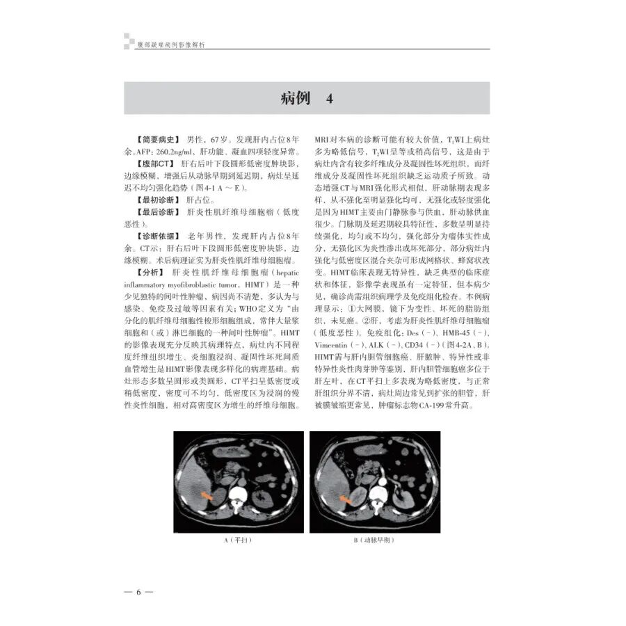 怎么买病理图文腹部疑难病例影像诊断及解析..._https://www.jmylbn.com_新闻资讯_第14张