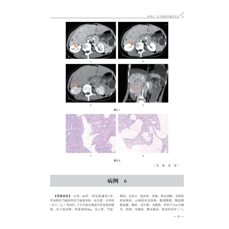怎么买病理图文腹部疑难病例影像诊断及解析..._https://www.jmylbn.com_新闻资讯_第17张