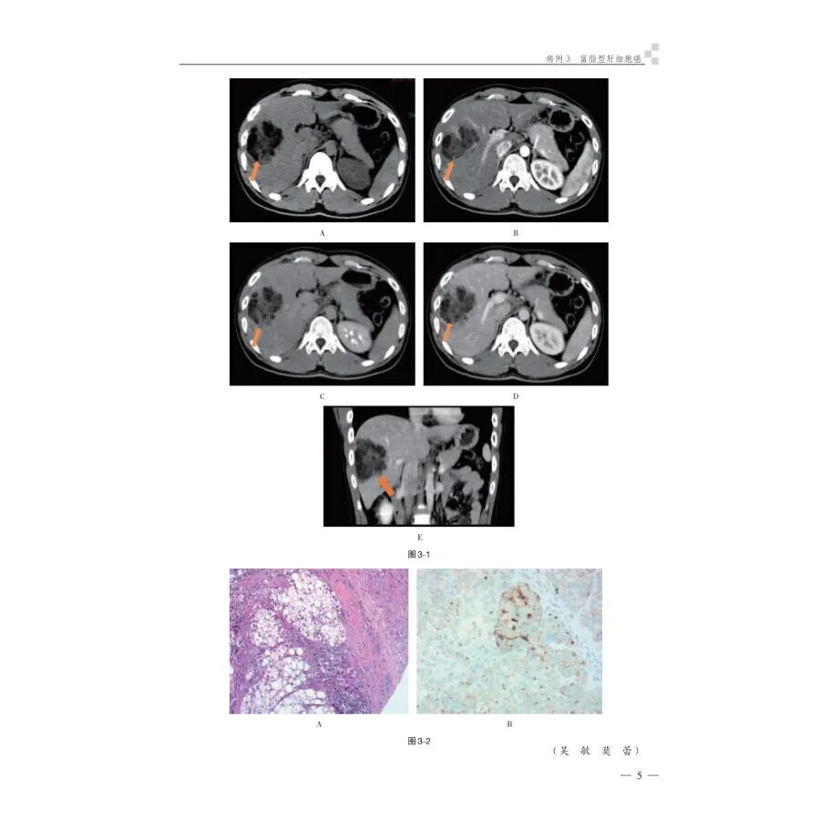 怎么买病理图文腹部疑难病例影像诊断及解析..._https://www.jmylbn.com_新闻资讯_第13张