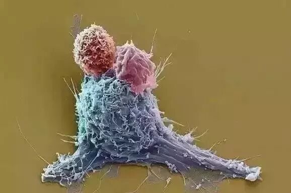 热点丨诺贝尔医学奖公布，癌症治疗方法彻底改变！