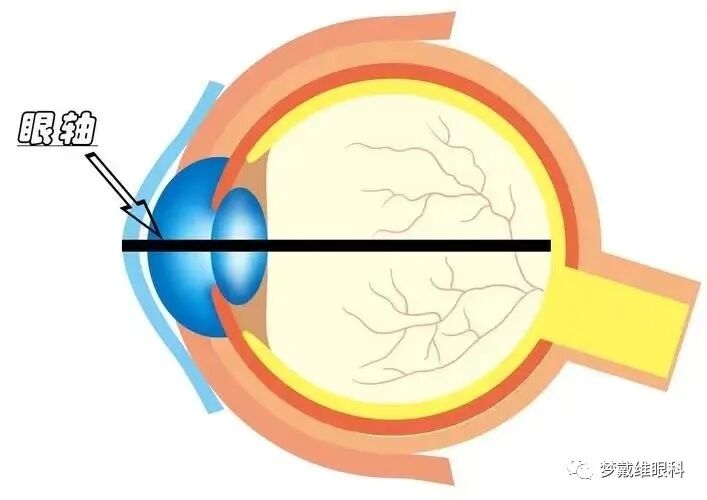 怎么测角膜直径眼生物测量仪-近视判断的金标准_https://www.jmylbn.com_新闻资讯_第11张