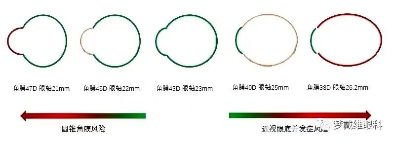 怎么测角膜直径眼生物测量仪-近视判断的金标准_https://www.jmylbn.com_新闻资讯_第10张