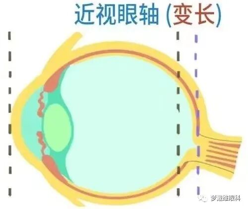 怎么测角膜直径眼生物测量仪-近视判断的金标准_https://www.jmylbn.com_新闻资讯_第20张