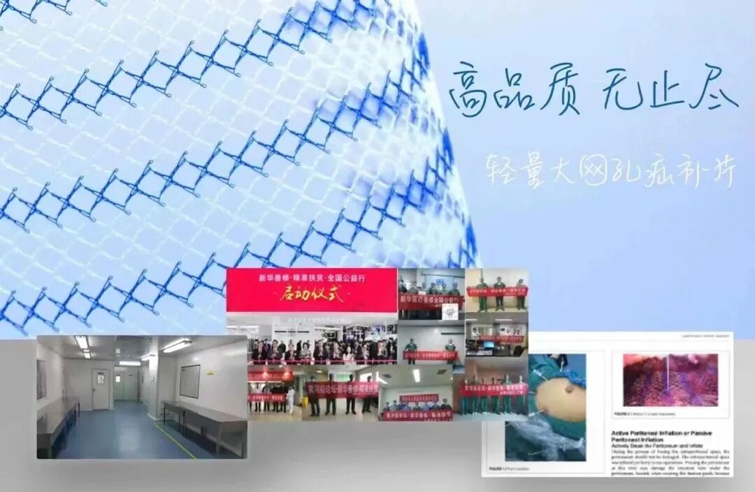 疝气补片怎么用疝外科小科普 ｜ 了解一下腹腔镜疝修补术用的“补片”吧！_https://www.jmylbn.com_新闻资讯_第4张