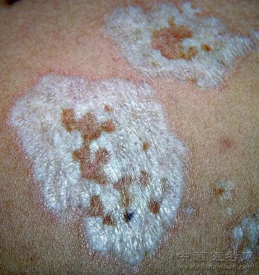 医学科普小编看完这个皮肤图谱整个人都不好了