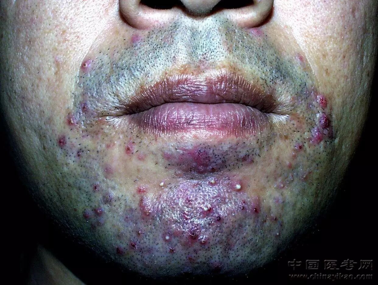 医学科普小编看完这个皮肤图谱整个人都不好了