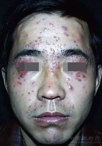 医学科普小编看完这个皮肤图谱整个人都不好了