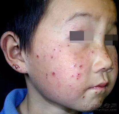 医学科普小编看完这个皮肤图谱整个人都不好了