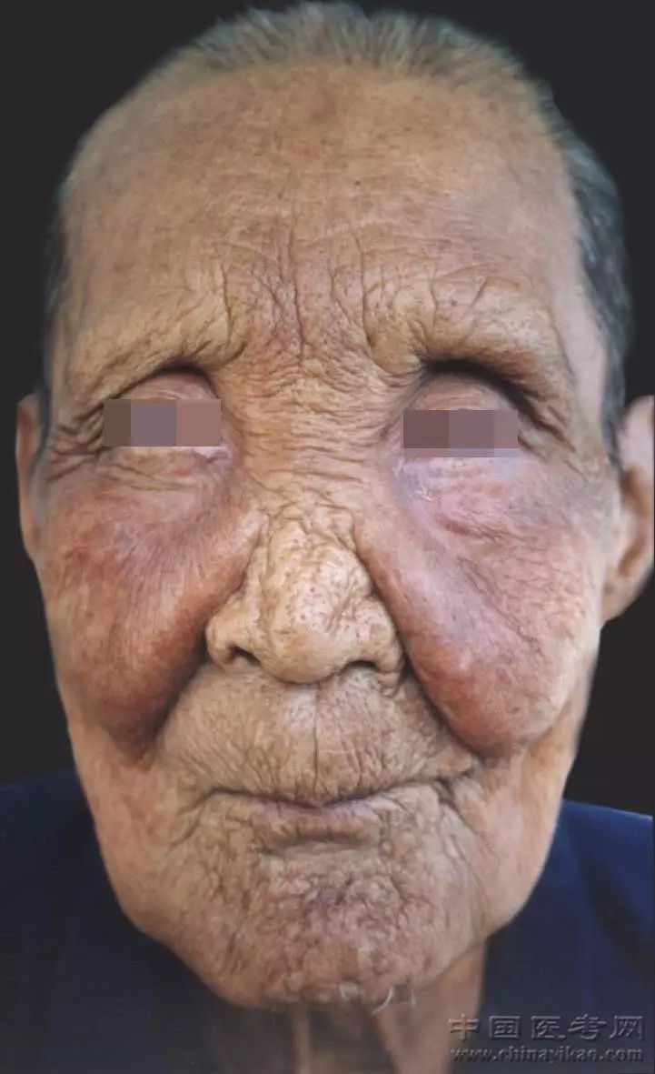 医学科普小编看完这个皮肤图谱整个人都不好了