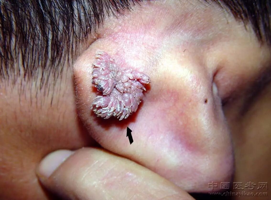 医学科普小编看完这个皮肤图谱整个人都不好了