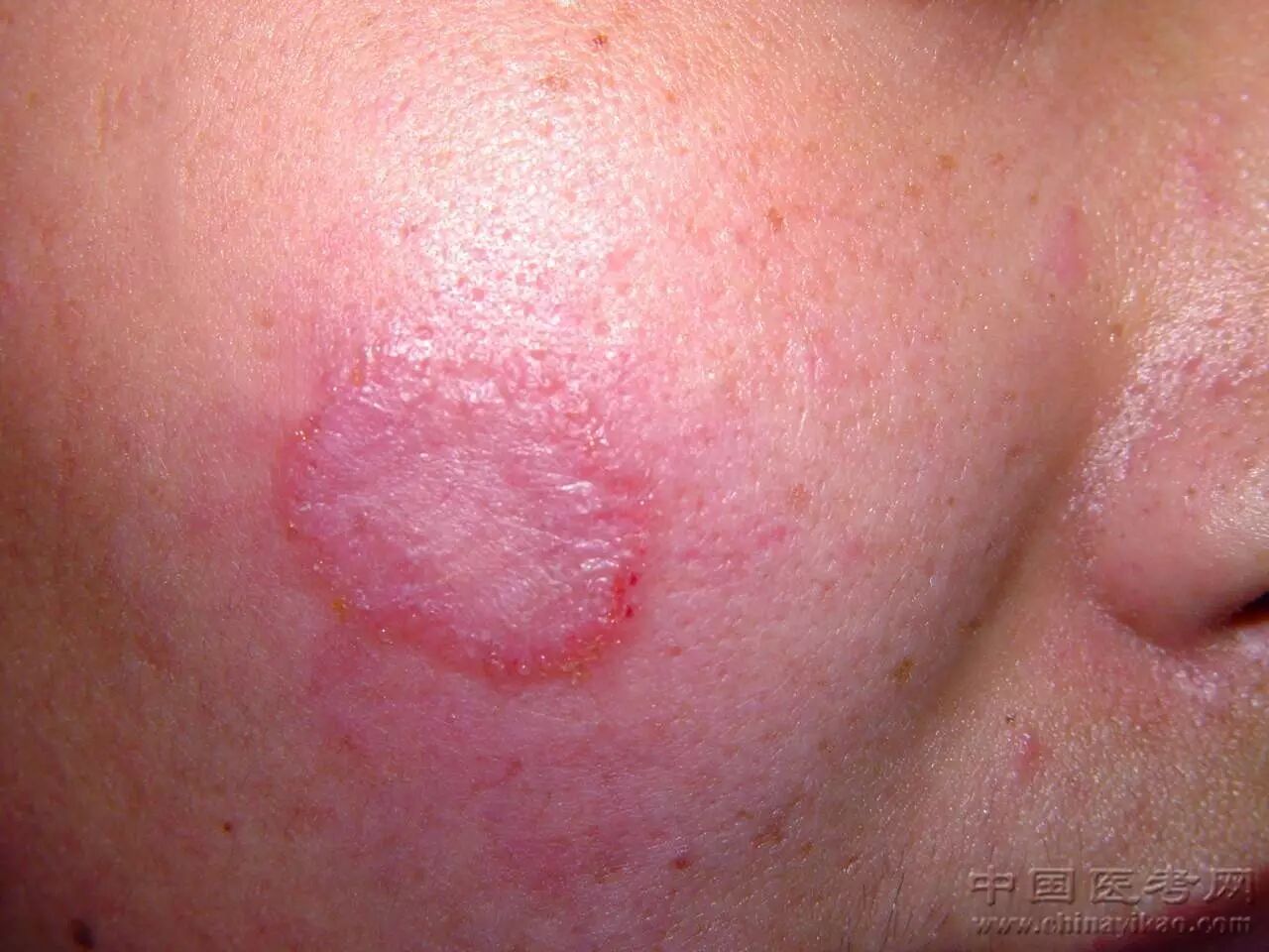 医学科普小编看完这个皮肤图谱整个人都不好了