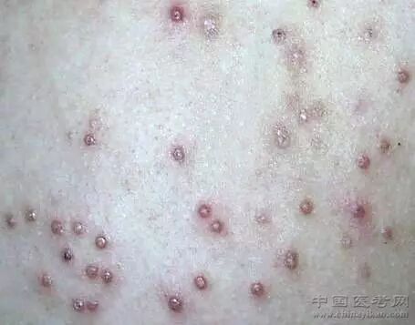 医学科普小编看完这个皮肤图谱整个人都不好了