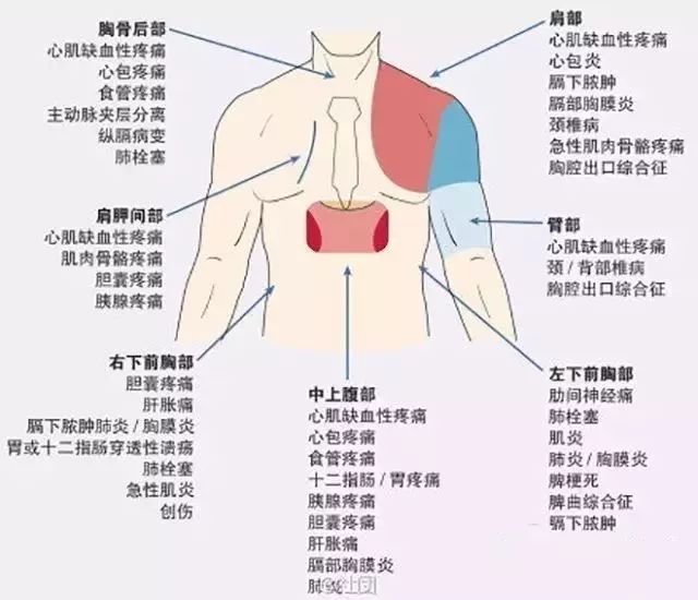 突發急性胸痛怎麼辦？這可能是你見到的最全的急救手冊！ 健康 第30張