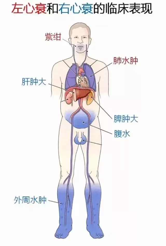 突發急性胸痛怎麼辦？這可能是你見到的最全的急救手冊！ 健康 第29張