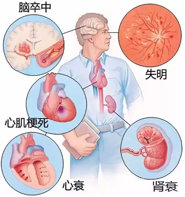 突發急性胸痛怎麼辦？這可能是你見到的最全的急救手冊！ 健康 第15張