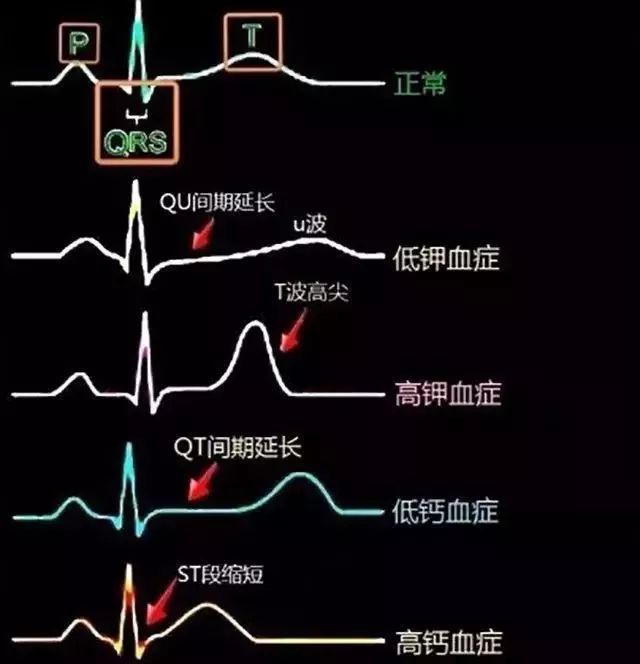 突發急性胸痛怎麼辦？這可能是你見到的最全的急救手冊！ 健康 第27張