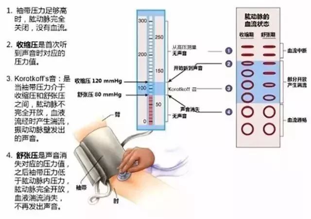 突發急性胸痛怎麼辦？這可能是你見到的最全的急救手冊！ 健康 第20張