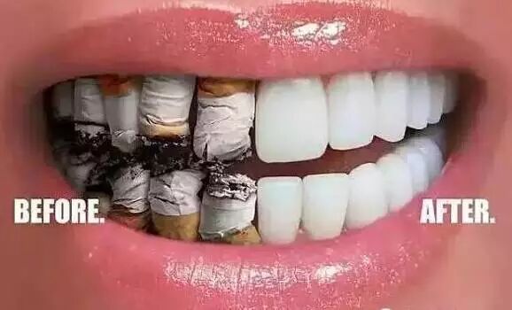 一组创意口腔广告，看完你才知道保护牙齿有多重要！