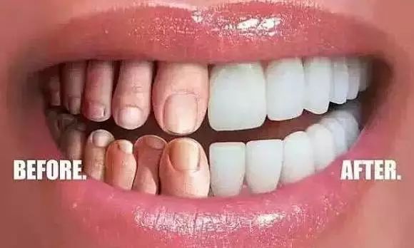 一组创意口腔广告，看完你才知道保护牙齿有多重要！