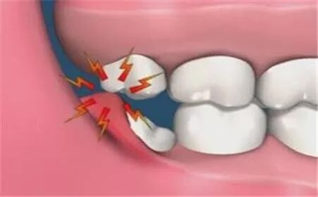 原来这九种病都与口腔牙齿健康有关