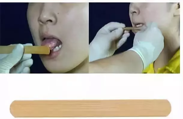 语言发育迟缓训练方法--构音器官训练法 语言发育迟缓训练方法--构音器官训练法