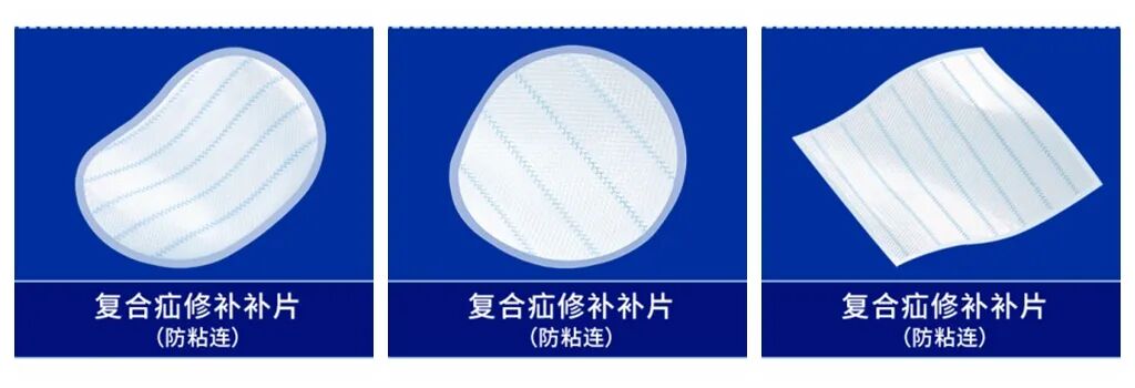 疝补片有什么品牌疝补片集采“末班车”已发动，康蒂娜医疗喊你上车_https://www.jmylbn.com_新闻资讯_第3张