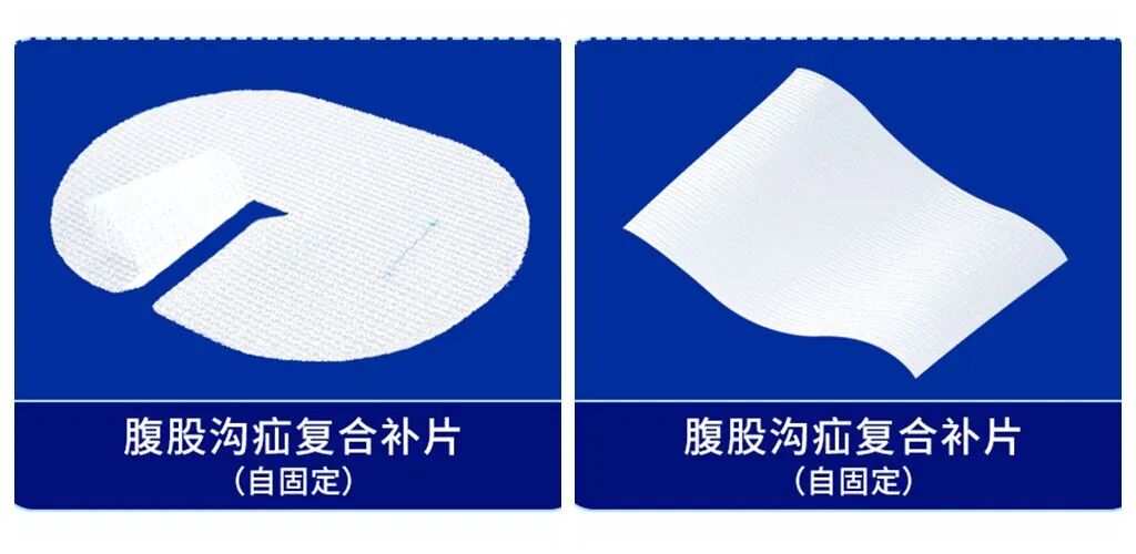 疝补片有什么品牌疝补片集采“末班车”已发动，康蒂娜医疗喊你上车_https://www.jmylbn.com_新闻资讯_第4张