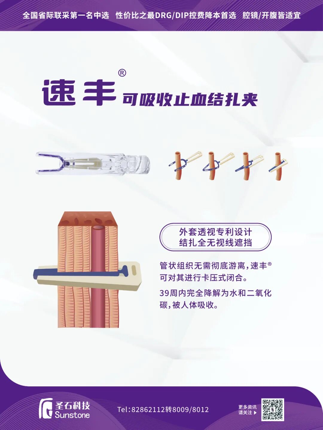 为什么手术会用到结扎夹全球首创！连发技术革新，腔镜外科装备再升级_https://www.jmylbn.com_新闻资讯_第2张