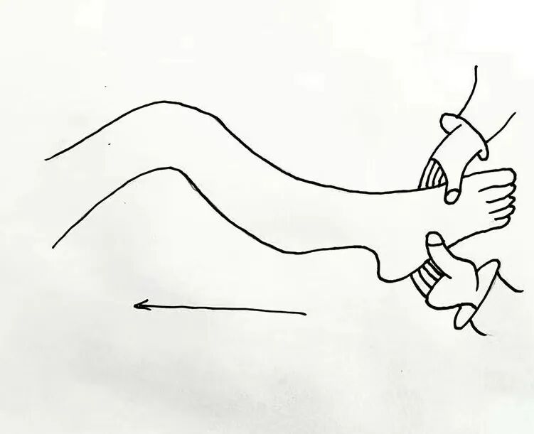 抗栓泵怎么用【健康科普】预防血栓知多少 小肺带你来探讨_https://www.jmylbn.com_新闻资讯_第6张